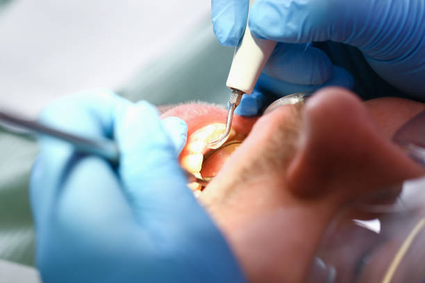 Best 24-Hour Emergency Dental Care in South Charleston, OH