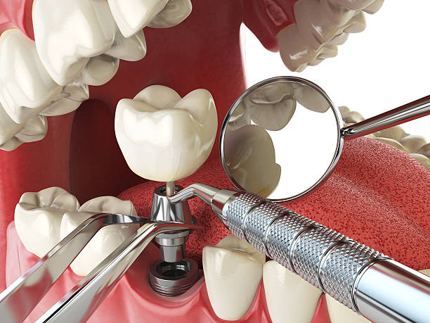 Best Weekend Emergency Dental Services in South Charleston, OH